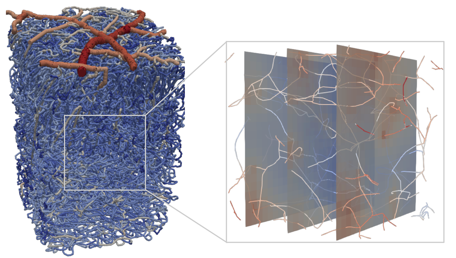 Webinar on Stroke across scales – impact on blood perfusion and oxygen supply in the brain – a computational perspective