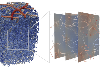 Stroke across scales – impact on blood perfusion and oxygen supply in the brain  – a computational perspective