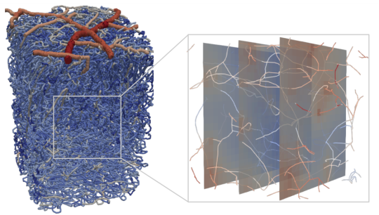 Stroke across scales – impact on blood perfusion and oxygen supply in the brain