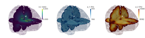 Modelling the brain as a poroelastic medium